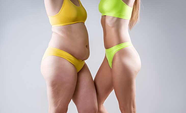 Your Guide to a Tummy Tuck – Before, During and After